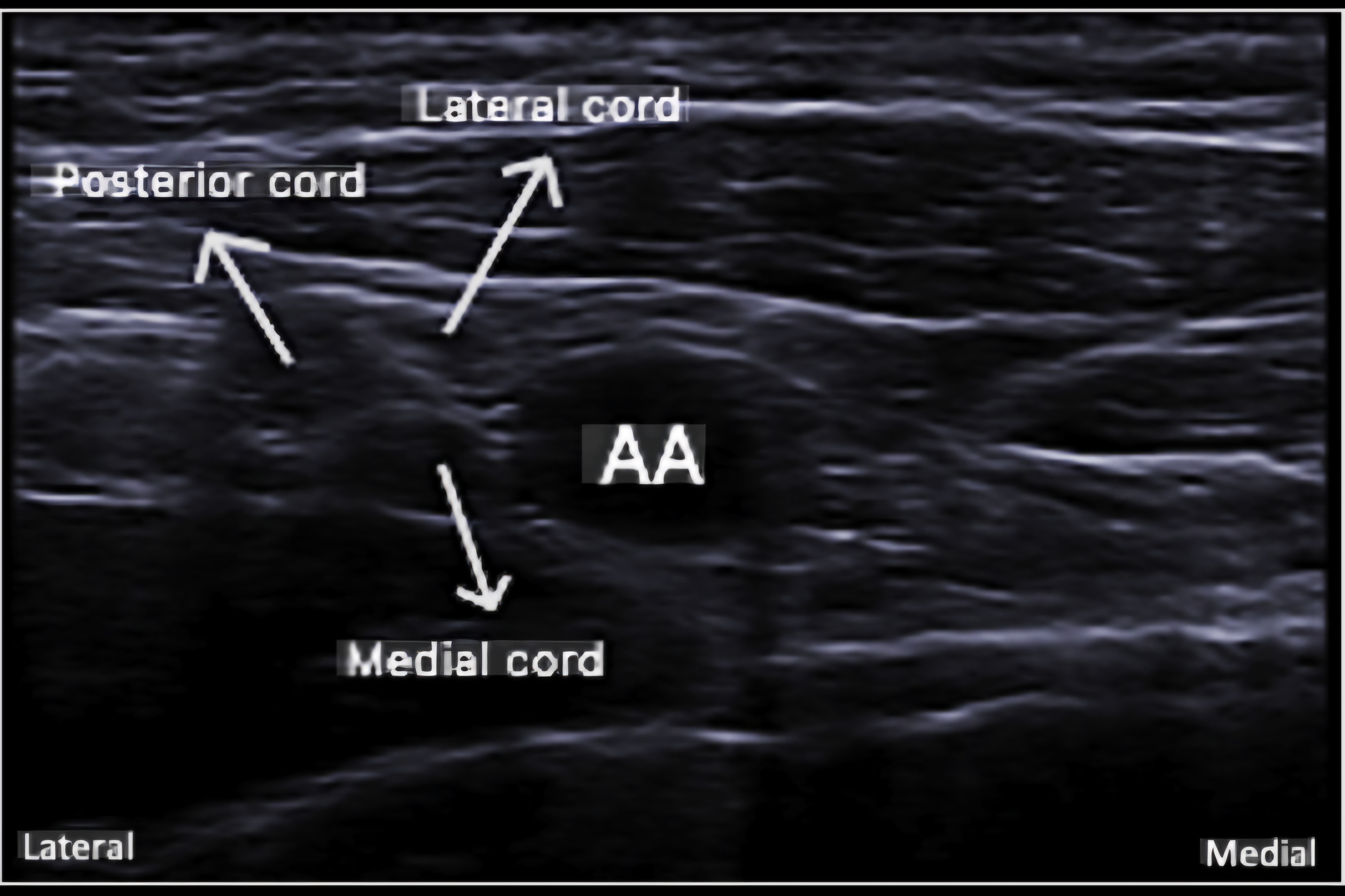 Question Reference Diagram