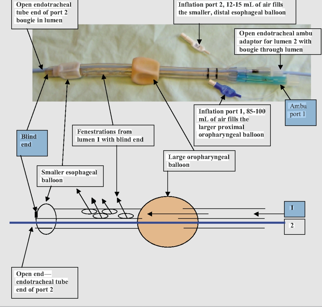 Question Reference Diagram